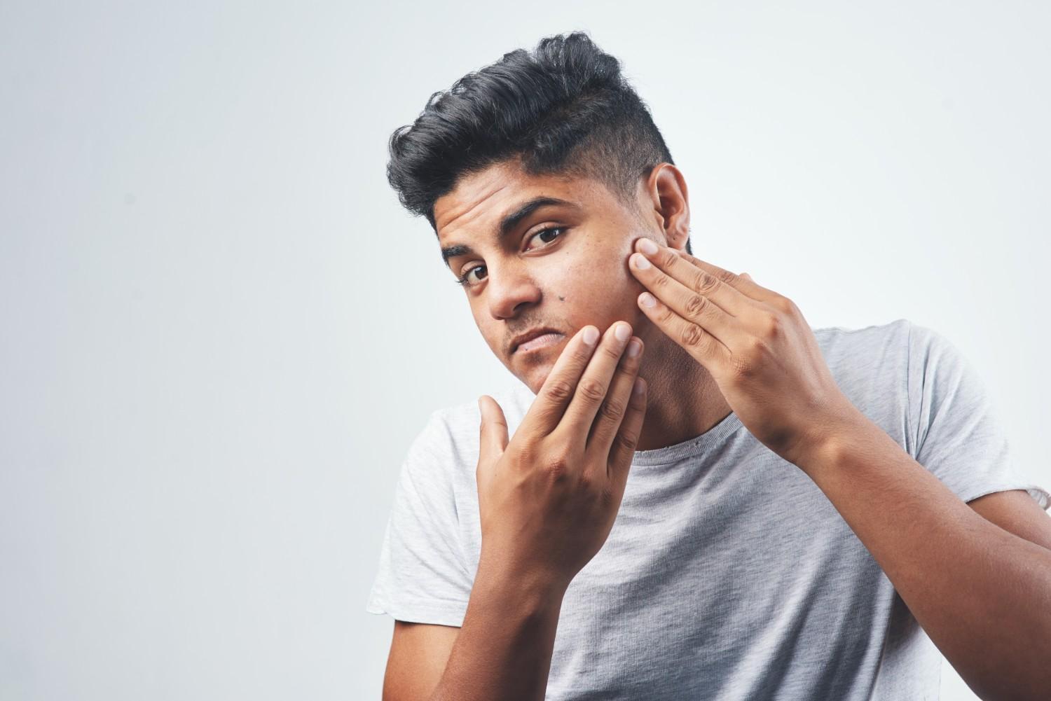 Can your gut microbiome affect your skin?